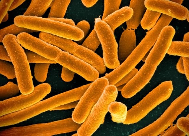 E. coli bacteria microscopy image